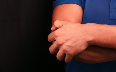 How to Treat Elbow Bursitis